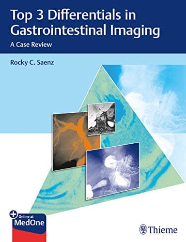 Top 3 Differentials in Gastrointestinal Imaging: A Case Review