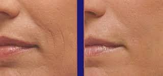 DNA CODE%C2%AE Skin Care Magic Collagen Booster-Time Reversing Serum with Argireline, Matrixyl 3000, Syn-Ake, SNAP-8, Copper Peptides