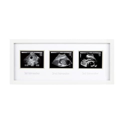 Pearhead Sonogram Progression Frame, Pregnancy Milestone Keepsake for 1st 2nd & 3rd Trimester Ultrasound Photos, Gender-Neutral Nursery Décor, White