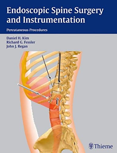 Endoscopic Spine Surgery and Instrumentation 1st Edition