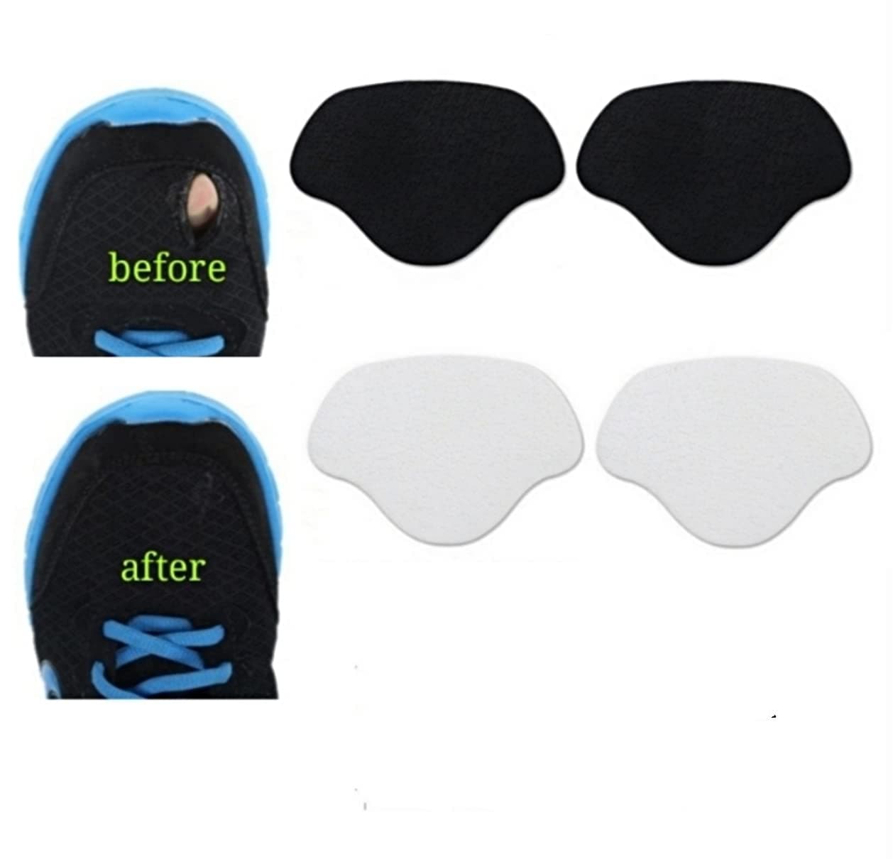 Sneaker Toe/Heel Prevention Repair, Shoe Hole Toeburst Patch/Insert, Wear Self-Adhesive, 1pairs of Black and 1 Pair of White