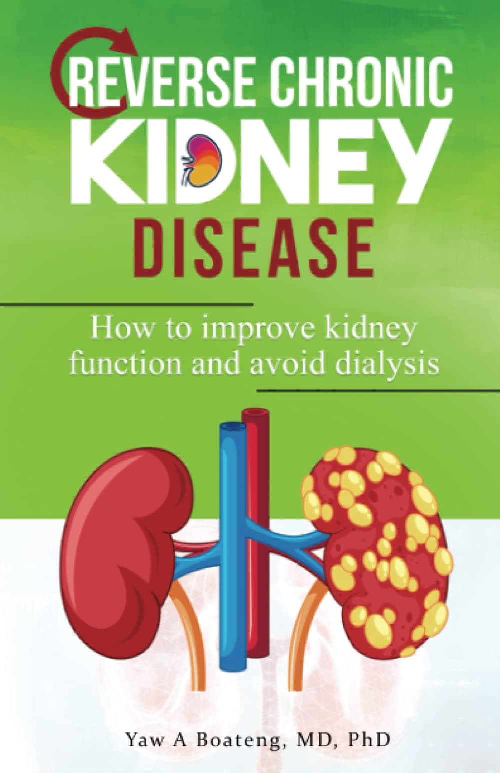 Reverse Chronic Kidney Disease: How To Improve Kidney Function And Avoid Dialysis Paperback – 1 November 2022