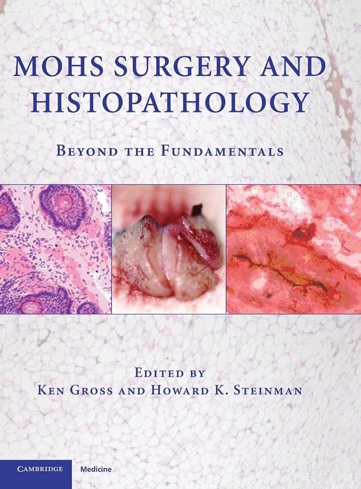 Mohs Surgery and Histopathology: Beyond the Fundamentals