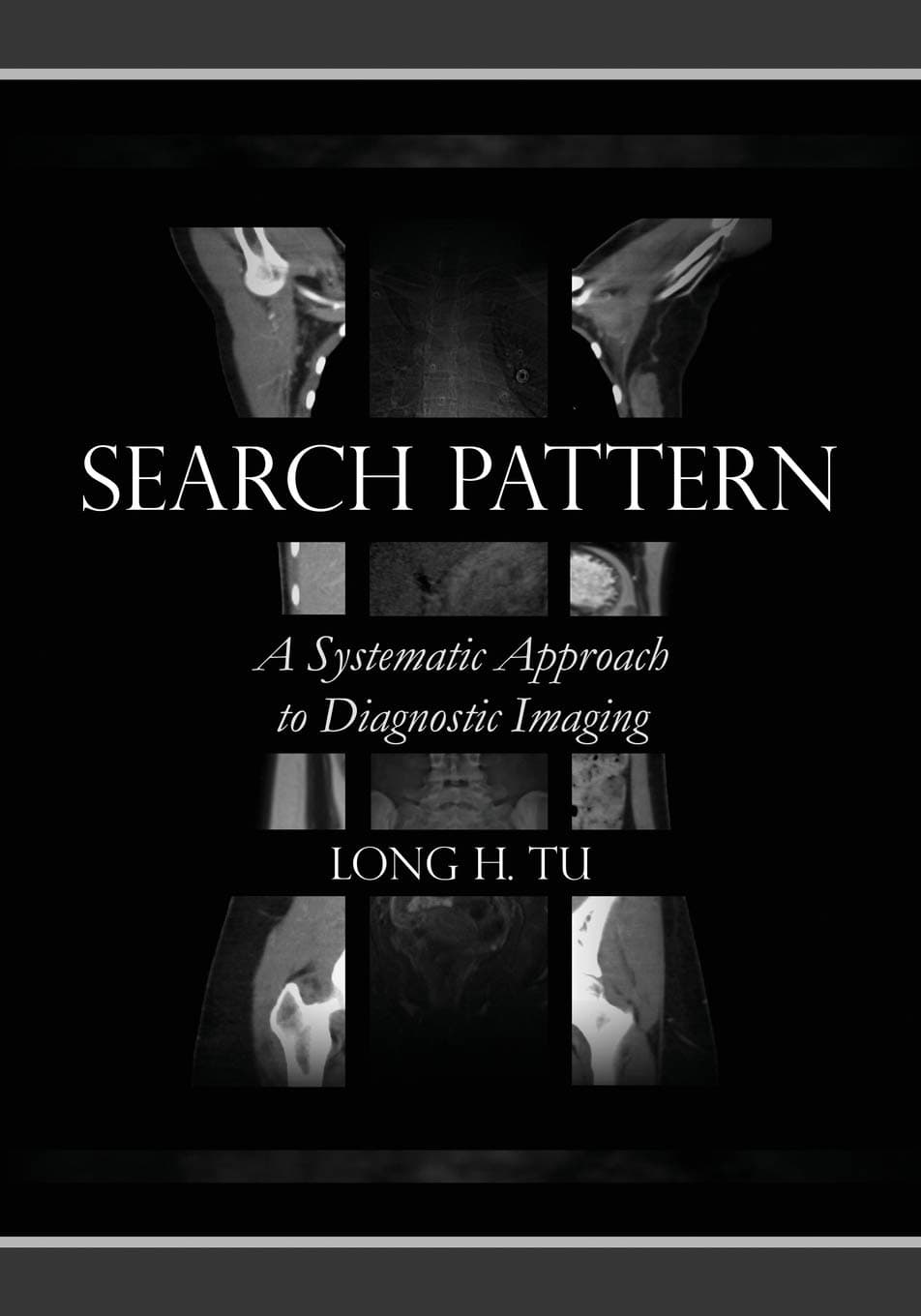 Search Pattern: A Systematic Approach to Diagnostic Imaging Paperback – 30 June 2020