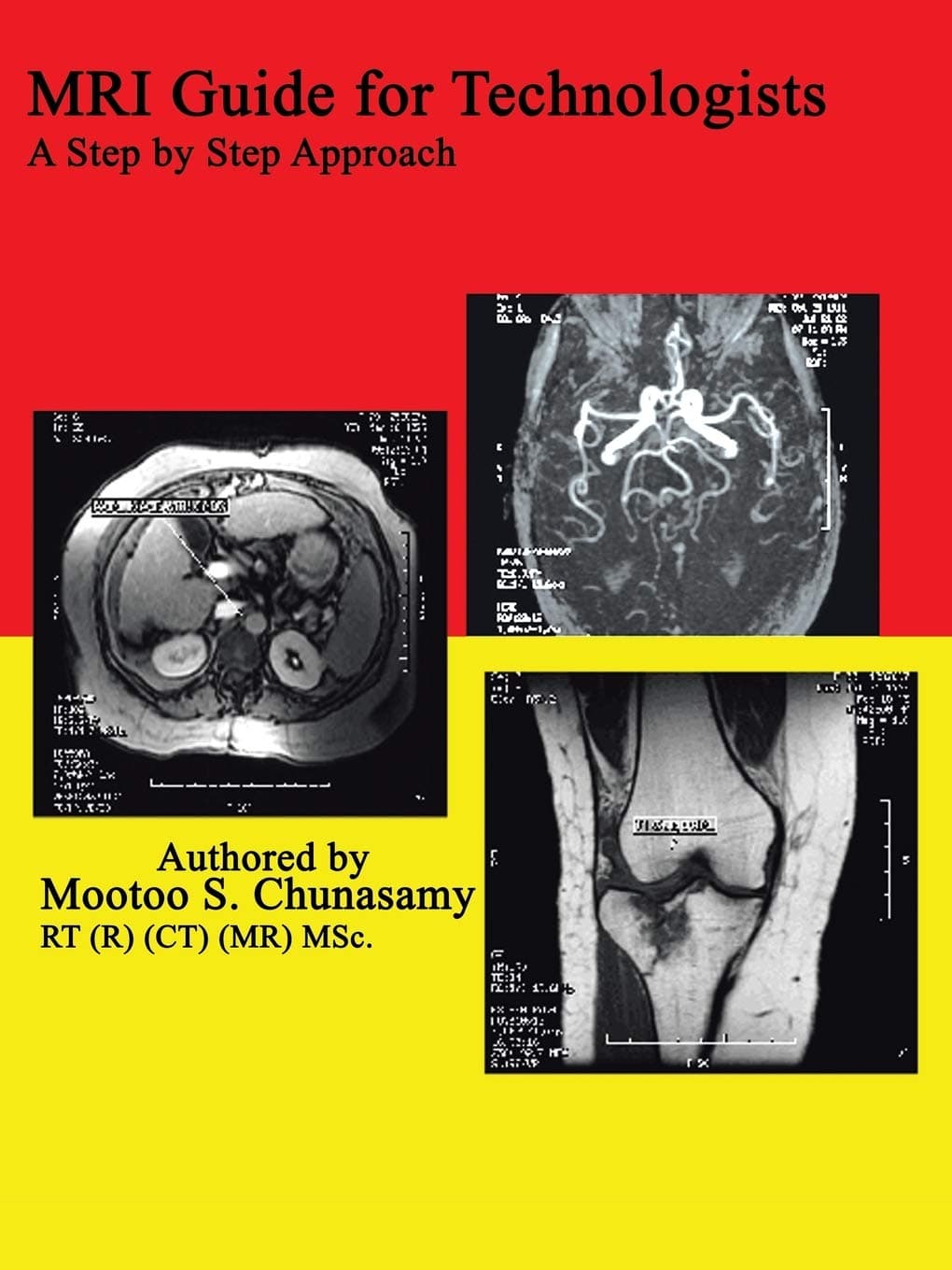 Mri Guide for Technologists: A Step by Step Approach: A Step by Step Approach Paperback – Illustrated, 30 September 2003