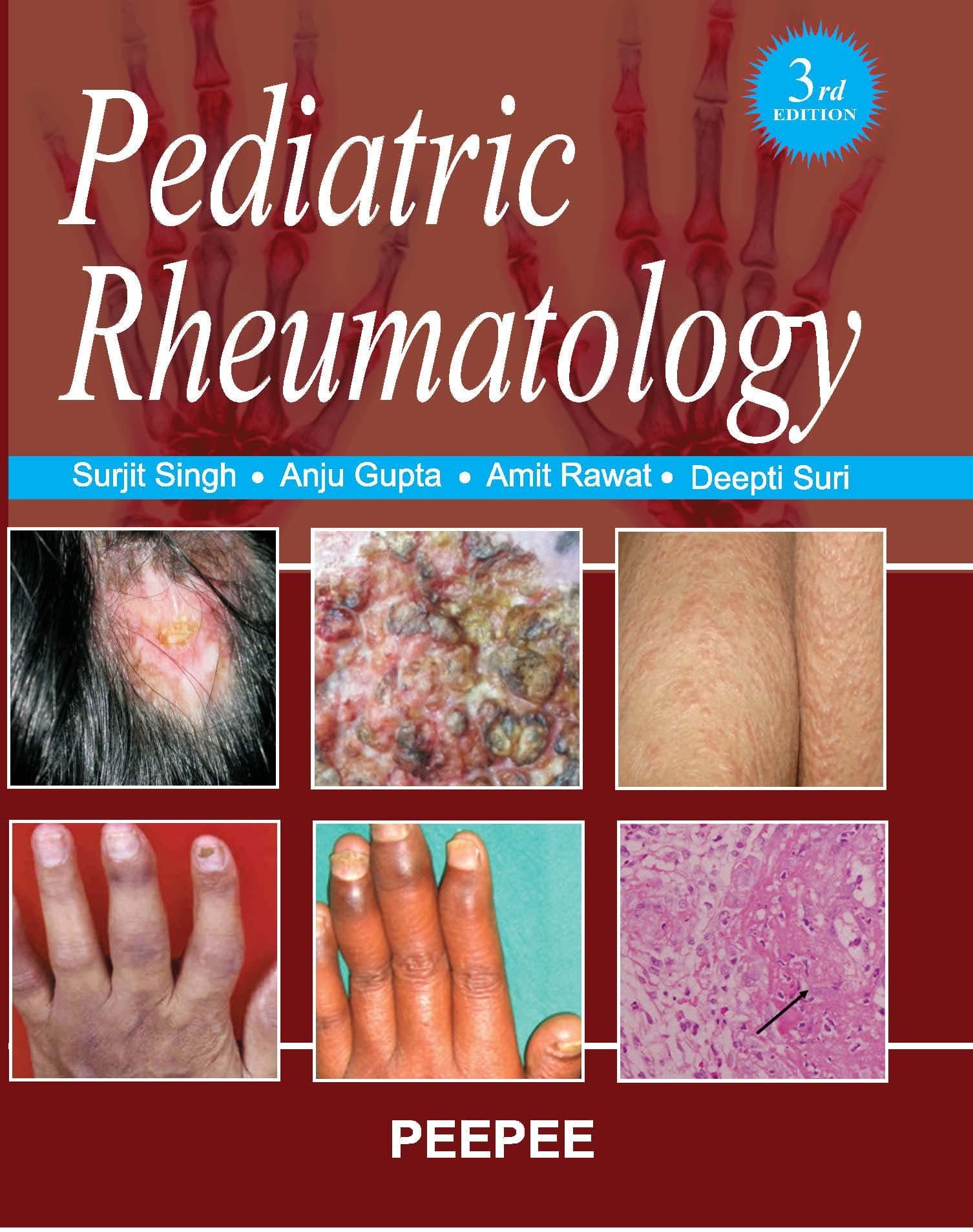 Pediatric Rheumatology Unknown Binding – 1 January 2018