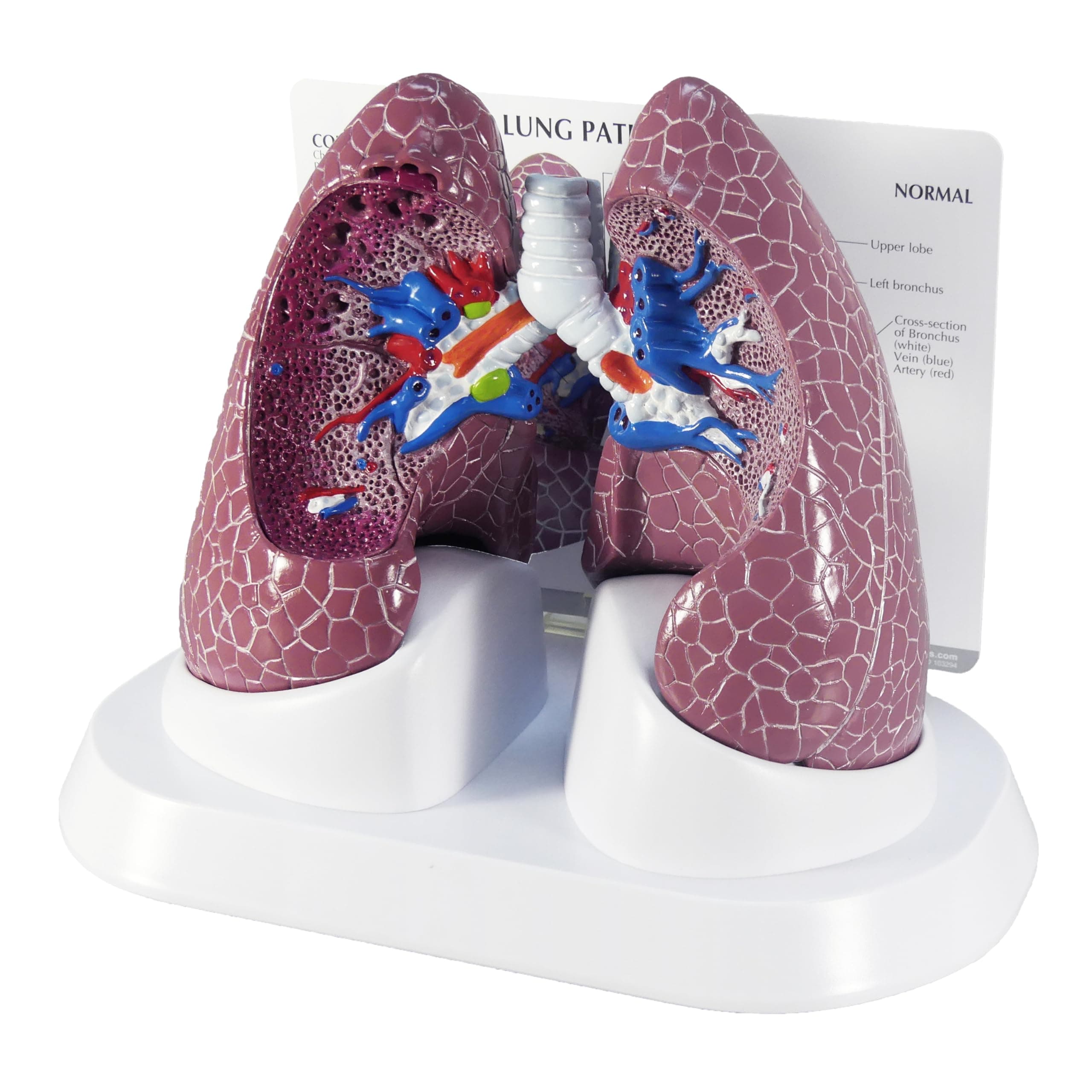 GPI Anatomicals - Lung Model Set with Pathologies, Replica for Human Anatomy and Physiology Education, Anatomy Model for Doctor's Offices and Classrooms, Medical Learning Resources