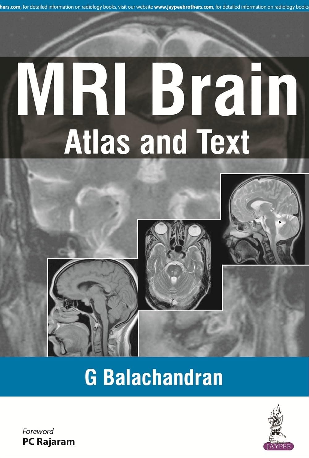 MRI Brain: Atlas and Text (POD)