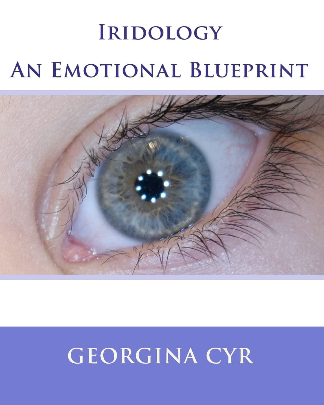 Iridology - An Emotional Blueprint