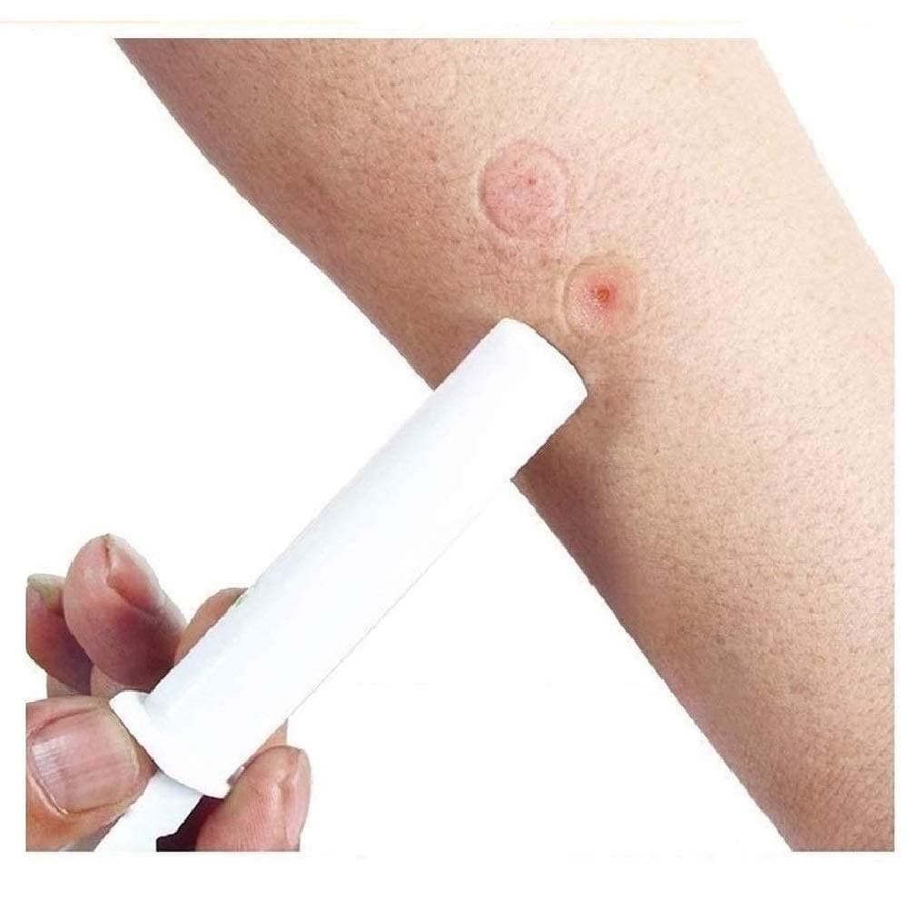 2PK Mosquito Bee Sting Bug Bite Kit Suction Tool Safety Supplies Natural First Aid for Hiking Backpacking Camping